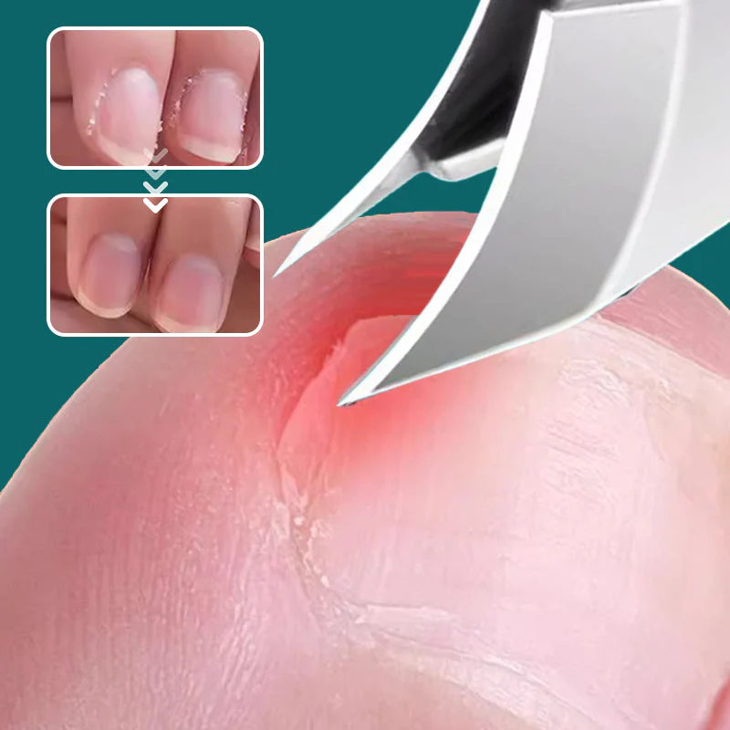🔥2025 Hot Sale🔥 Anti-Splash 25° Slant Edge Nail Clipper 3-Piece Set - Image 4