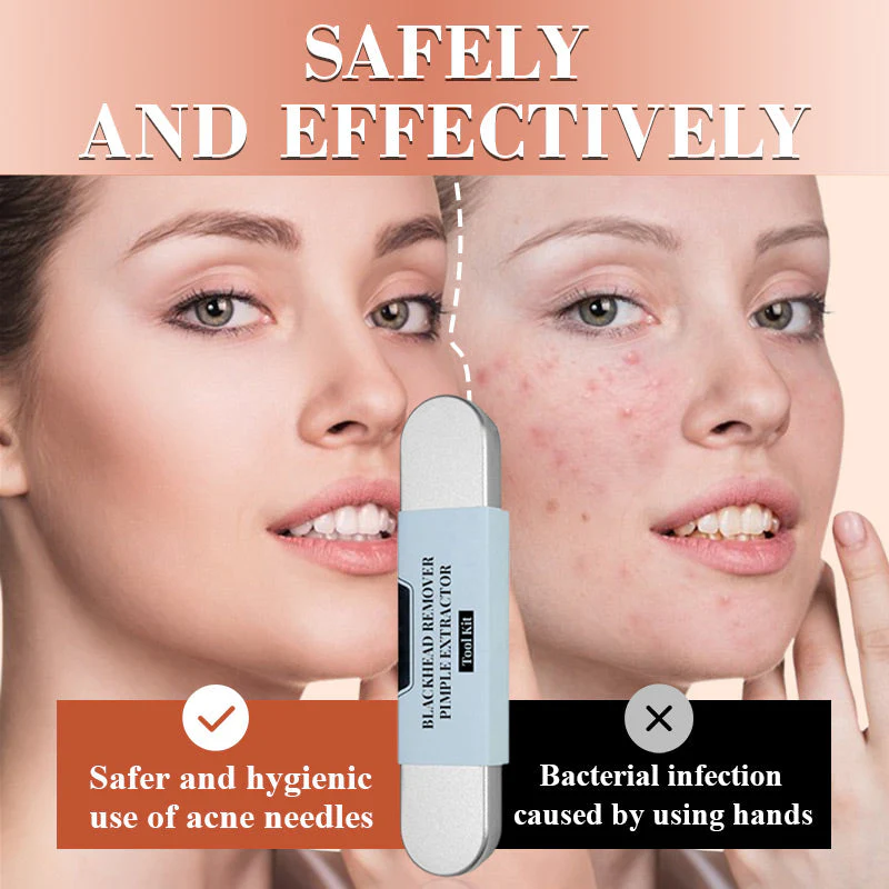 💓HOT SALE 50% OFF💥Stainless Steel Blackhead Remover Tool Kit - Image 2