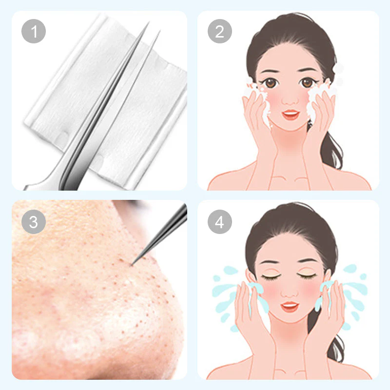 💓HOT SALE 50% OFF💥Stainless Steel Blackhead Remover Tool Kit - Image 7