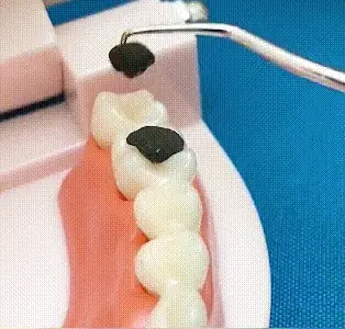 🏆German precision engineering! 0.1mm ultra-fine tip for precise flossing✨ - Image 2