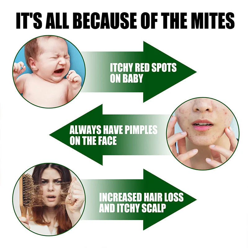 ⌛Limited Sale 50% OFF🔥Powerful Mite Remover Spray - Image 3