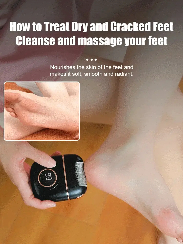 🔥Hot Sale💝New Digital Electric Foot Polisher - Image 2