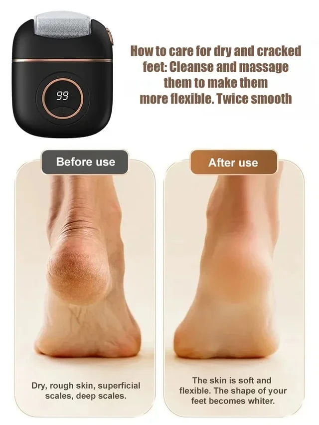 🔥Hot Sale💝New Digital Electric Foot Polisher - Image 3